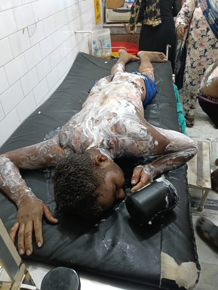 ਧਨੌਲਾ ਦੇ ਪ੍ਰਸਿੱਧ ਪ੍ਰਾਚੀਨ ਮੰਦਰ ਹਨੂੰਮਾਨ ਬਰਨੇਵਾਲਾ ਦੇ ਲੰਗਰ ਹਾਲ ‘ਚ ਅੱਗ ਲੱਗਣ ਕਾਰਨ 15 ਜਣੇ ਜ਼ਖ਼ਮੀ